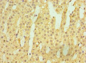HSD11B1 / HSD11B Antibody - Immunohistochemistry of paraffin-embedded human adrenal gland using antibody at 1:100 dilution.