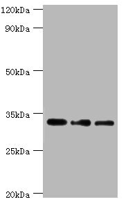 HSD11B1 / HSD11B Antibody - Western blot All lanes: Corticosteroid 11-beta-dehydrogenase isozyme 1 antibody at 7µg/ml Lane 1: Mouse liver tissue Lane 2: Jurkat whole cell lysate Lane 3: LO2 whole cell lysate Secondary Goat polyclonal to rabbit IgG at 1/10000 dilution Predicted band size: 32 kDa Observed band size: 32 kDa