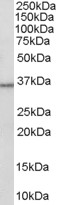 HSD11B1 / HSD11B Antibody - Antibody (0.3 ug/ml) staining of Human Liver lysate (35 ug protein in RIPA buffer). Primary incubation was 1 hour. Detected by chemiluminescence.