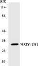 HSD11B1 / HSD11B Antibody - Western blot analysis of the lysates from HUVECcells using HSD11B1 antibody.