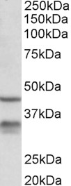 HSD11B1 / HSD11B Antibody - HSD11B1 antibody (0.3 ug/ml) staining of Mouse Lung lysate (35 ug protein in RIPA buffer). Primary incubation was 1 hour. Detected by chemiluminescence.