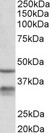 HSD11B1 / HSD11B Antibody - HSD11B1 antibody (0.3 ug/ml) staining of Mouse Lung lysate (35 ug protein in RIPA buffer). Primary incubation was 1 hour. Detected by chemiluminescence.
