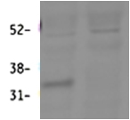 HSD11B1 / HSD11B Antibody - HSD11B1 antibody (0.3 ug/ml) staining of Mouse Lung lysate (60 ug protein in RIPA buffer). First lane shows wild type and second lane shows knockout background. Primary incubation was overnight. Detected by fluorescence with Li-cor). Data obtained from Prof. K. Chapman and Zhenguang Zhang, Centre for Cardiovascular Sciences, Queens Medical Research Institute, Edinburgh, UK