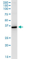 HSD11B1 / HSD11B Antibody - HSD11B1 monoclonal antibody (M02A), clone 2C10. Western Blot analysis of HSD11B1 expression in human liver.