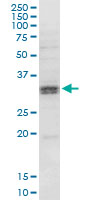 HSD11B1 / HSD11B Antibody - HSD11B1 monoclonal antibody (M02A), clone 2C10. Western Blot analysis of HSD11B1 expression in MCF-7.