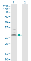HSD11B1 / HSD11B Antibody - Western Blot analysis of HSD11B1 expression in transfected 293T cell line by HSD11B1 monoclonal antibody (M02A), clone 2C10.Lane 1: HSD11B1 transfected lysate (Predicted MW: 32.4 KDa).Lane 2: Non-transfected lysate.
