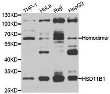 HSD11B1 / HSD11B Antibody - Western blot analysis of extracts of various cell lines.