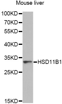 HSD11B1 / HSD11B Antibody - Western blot analysis of extracts of mouse liver, using HSD11B1 antibody at 1:1000 dilution. The secondary antibody used was an HRP Goat Anti-Rabbit IgG (H+L) at 1:10000 dilution. Lysates were loaded 25ug per lane and 3% nonfat dry milk in TBST was used for blocking. An ECL Kit was used for detection and the exposure time was 90s.