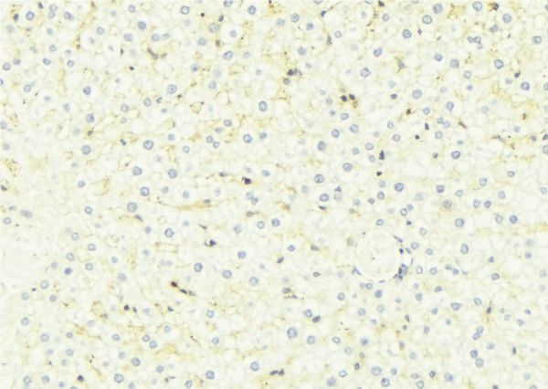 HSD11B1 / HSD11B Antibody - 1:100 staining mouse liver tissue by IHC-P. The sample was formaldehyde fixed and a heat mediated antigen retrieval step in citrate buffer was performed. The sample was then blocked and incubated with the antibody for 1.5 hours at 22°C. An HRP conjugated goat anti-rabbit antibody was used as the secondary.