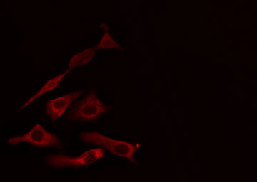 HSD11B1 / HSD11B Antibody - Staining HuvEc cells by IF/ICC. The samples were fixed with PFA and permeabilized in 0.1% Triton X-100, then blocked in 10% serum for 45 min at 25°C. The primary antibody was diluted at 1:200 and incubated with the sample for 1 hour at 37°C. An Alexa Fluor 594 conjugated goat anti-rabbit IgG (H+L) antibody, diluted at 1/600, was used as secondary antibody.