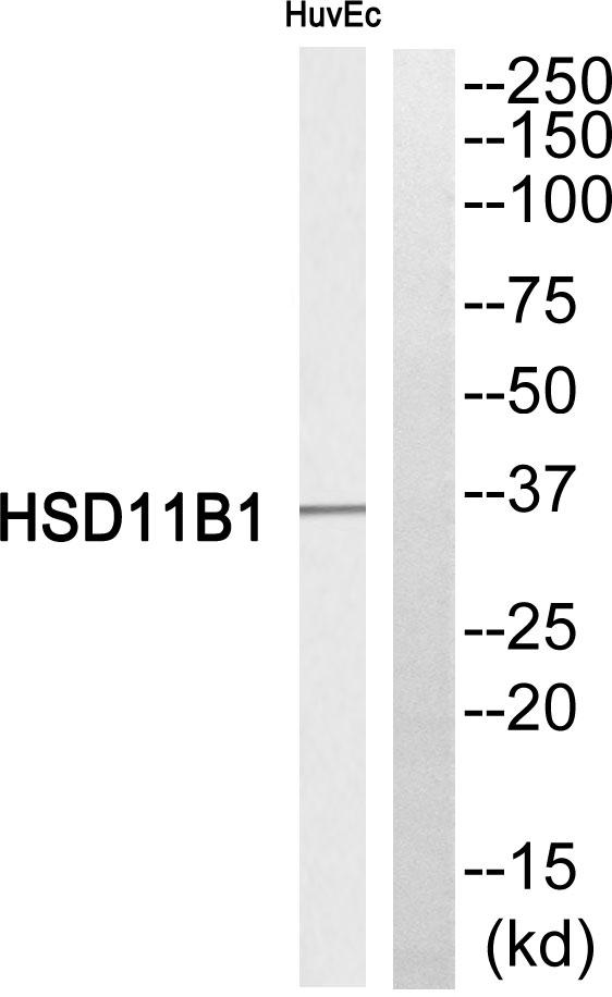 HSD11B1 / HSD11B Antibody - Western blot analysis of extracts from HuvEc cells, using HSD11B1 antibody.