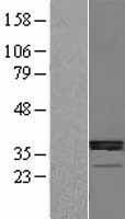 HSD11B1 / HSD11B Protein - Western validation with an anti-DDK antibody * L: Control HEK293 lysate R: Over-expression lysate