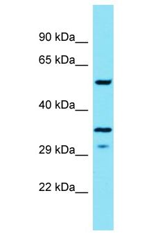 HSD11B1L Antibody - HSD11B1L antibody Western Blot of RPMI-8226. Antibody dilution: 1 ug/ml.  This image was taken for the unconjugated form of this product. Other forms have not been tested.