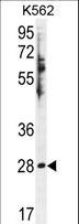 HSD11B1L Antibody - HSD11B1L Antibody western blot of K562 cell line lysates (35 ug/lane). The HSD11B1L antibody detected the HSD11B1L protein (arrow).