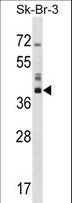 HSD17 / HSD17B1 Antibody - HSD17B1 Antibody western blot of SK-BR-3 cell line lysates (35 ug/lane). The HSD17B1 antibody detected the HSD17B1 protein (arrow).