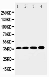 HSD17 / HSD17B1 Antibody - HSD17B1 antibody Western blot. Lane 1: Rat Kidney Tissue Lysate. Lane 2: Rat Liver Tissue Lysate. Lane 3: 293T Cell Lysate. Lane 4: HELA Cell Lysate.