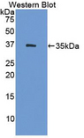 HSD17 / HSD17B1 Antibody - Western blot of recombinant HSD17 / HSD17B1.