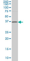 HSD17 / HSD17B1 Antibody - HSD17B1 monoclonal antibody (M03), clone 2E5 Western blot of HSD17B1 expression in Jurkat.