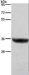 HSD17 / HSD17B1 Antibody - Western blot analysis of Human placenta tissue, using HSD17B1 Polyclonal Antibody at dilution of 1:700.