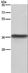 HSD17 / HSD17B1 Antibody - Western blot analysis of Human placenta tissue, using HSD17B1 Polyclonal Antibody at dilution of 1:600.