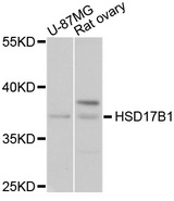 HSD17 / HSD17B1 Antibody - Western blot analysis of extracts of various cell lines, using HSD17B1 antibody at 1:1000 dilution. The secondary antibody used was an HRP Goat Anti-Rabbit IgG (H+L) at 1:10000 dilution. Lysates were loaded 25ug per lane and 3% nonfat dry milk in TBST was used for blocking. An ECL Kit was used for detection and the exposure time was 5s.