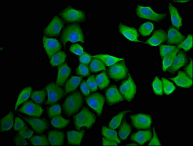HSD17 / HSD17B1 Antibody - Immunofluorescence staining of Hela cells with HSD17B1 Antibody at 1:33, counter-stained with DAPI. The cells were fixed in 4% formaldehyde, permeabilized using 0.2% Triton X-100 and blocked in 10% normal Goat Serum. The cells were then incubated with the antibody overnight at 4°C. The secondary antibody was Alexa Fluor 488-congugated AffiniPure Goat Anti-Rabbit IgG(H+L).