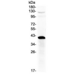 HSD17 / HSD17B1 Antibody - Western blot testing of human placenta lysate with HSD17B1 antibody at 0.5ug/ml. Predicted molecular weight ~35 kDa.