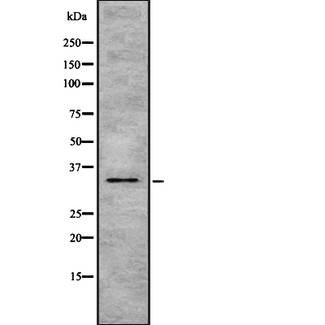 HSD17 / HSD17B1 Antibody - Western blot analysis of HSD17B1 using MCF-7 whole lysates.