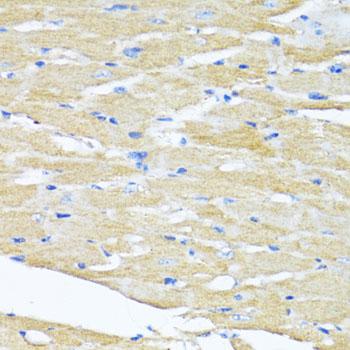 HSD17 / HSD17B1 Antibody - Immunohistochemistry of paraffin-embedded Mouse heart using HSD17B1 Polyclonal Antibody at dilution of 1:100 (40x lens).