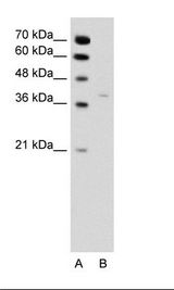 HSD17 / HSD17B1 Antibody - A: Marker, B: Jurkat Cell Lysate.  This image was taken for the unconjugated form of this product. Other forms have not been tested.