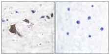 HSD17B10 / HADH2 Antibody - Immunohistochemistry analysis of paraffin-embedded human brain tissue, using ERAB Antibody. The picture on the right is blocked with the synthesized peptide.