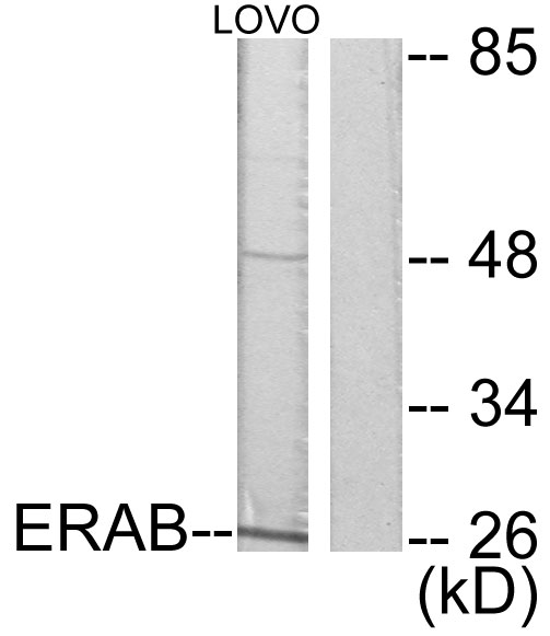 HSD17B10 / HADH2 Antibody - Western blot analysis of lysates from LOVO cells, using ERAB Antibody. The lane on the right is blocked with the synthesized peptide.