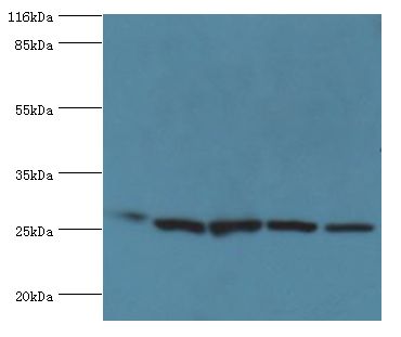 HSD17B10 / HADH2 Antibody - Western blot. All lanes: 3-hydroxyacyl-CoA dehydrogenase type-2 antibody at 2 ug/ml Lane 1:mouse brain tissue Lane 2: 293T whole cell lysate. Lane 3: HepG2 whole cell lysate Lane 4: HeLa whole cell lysate Lane 5: HT29 whole cell lysate. Secondary antibody: Goat polyclonal.  This image was taken for the unconjugated form of this product. Other forms have not been tested.