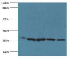 HSD17B10 / HADH2 Antibody - Western blot. All lanes: 3-hydroxyacyl-CoA dehydrogenase type-2 antibody at 2 ug/ml Lane 1:mouse brain tissue Lane 2: 293T whole cell lysate. Lane 3: HepG2 whole cell lysate Lane 4: HeLa whole cell lysate Lane 5: HT29 whole cell lysate. Secondary antibody: Goat polyclonal.  This image was taken for the unconjugated form of this product. Other forms have not been tested.