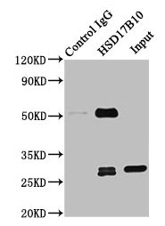 HSD17B10 / HADH2 Antibody - Immunoprecipitating HSD17B10 in 293T whole cell lysate Lane 1: Rabbit control IgG instead of HSD17B10 Antibody in 293T whole cell lysate.For western blotting, a HRP-conjugated Protein G antibody was used as the secondary antibody (1/2000) Lane 2: HSD17B10 Antibody (8µg) + 293T whole cell lysate (500µg) Lane 3: 293T whole cell lysate (10µg)