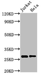 HSD17B10 / HADH2 Antibody - Western Blot Positive WB detected in: Jurkat whole cell lysate, Hela whole cell lysate All lanes: HSD17B10 antibody at 3µg/ml Secondary Goat polyclonal to rabbit IgG at 1/50000 dilution Predicted band size: 27, 26 kDa Observed band size: 27 kDa