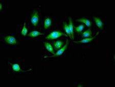 HSD17B10 / HADH2 Antibody - Immunofluorescence staining of A549 cells with HSD17B10 Antibody at 1:133, counter-stained with DAPI. The cells were fixed in 4% formaldehyde, permeabilized using 0.2% Triton X-100 and blocked in 10% normal Goat Serum. The cells were then incubated with the antibody overnight at 4°C. The secondary antibody was Alexa Fluor 488-congugated AffiniPure Goat Anti-Rabbit IgG(H+L).