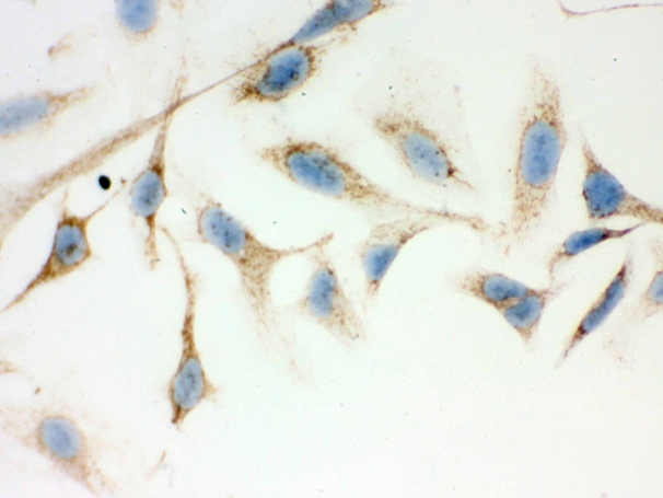 HSD17B10 / HADH2 Antibody - IHC analysis of ERAB using anti-ERAB antibody. ERAB was detected in immunocytochemical section of Hela cell. Heat mediated antigen retrieval was performed in citrate buffer (pH6, epitope retrieval solution) for 20 mins. The tissue section was blocked with 10% goat serum. The tissue section was then incubated with 1µg/ml rabbit anti-ERAB Antibody overnight at 4°C. Biotinylated goat anti-rabbit IgG was used as secondary antibody and incubated for 30 minutes at 37°C. The tissue section was developed using Strepavidin-Biotin-Complex (SABC) with DAB as the chromogen.