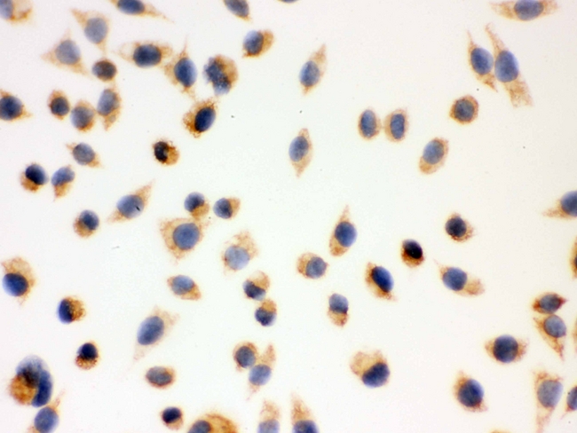 HSD17B10 / HADH2 Antibody - IHC analysis of ERAB using anti-ERAB antibody. ERAB was detected in immunocytochemical section of SMMC-7721 cell. Heat mediated antigen retrieval was performed in citrate buffer (pH6, epitope retrieval solution) for 20 mins. The tissue section was blocked with 10% goat serum. The tissue section was then incubated with 1µg/ml rabbit anti-ERAB Antibody overnight at 4°C. Biotinylated goat anti-rabbit IgG was used as secondary antibody and incubated for 30 minutes at 37°C. The tissue section was developed using Strepavidin-Biotin-Complex (SABC) with DAB as the chromogen.
