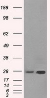 HSD17B10 / HADH2 Antibody - HEK293T cells were transfected with the pCMV6-ENTRY control (Left lane) or pCMV6-ENTRY HSD17B10 (Right lane) cDNA for 48 hrs and lysed. Equivalent amounts of cell lysates (5 ug per lane) were separated by SDS-PAGE and immunoblotted with anti-HSD17B10.