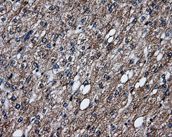 HSD17B10 / HADH2 Antibody - IHC of paraffin-embedded liver tissue using anti-HSD17B10 mouse monoclonal antibody. (Dilution 1:50).