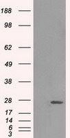 HSD17B10 / HADH2 Antibody - HEK293T cells were transfected with the pCMV6-ENTRY control (Left lane) or pCMV6-ENTRY HSD17B10 (Right lane) cDNA for 48 hrs and lysed. Equivalent amounts of cell lysates (5 ug per lane) were separated by SDS-PAGE and immunoblotted with anti-HSD17B10.