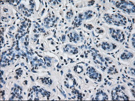 HSD17B10 / HADH2 Antibody - IHC of paraffin-embedded Human breast tissue using anti-HSD17B10 mouse monoclonal antibody.