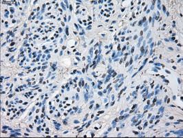 HSD17B10 / HADH2 Antibody - IHC of paraffin-embedded Human endometrium tissue using anti-HSD17B10 mouse monoclonal antibody.