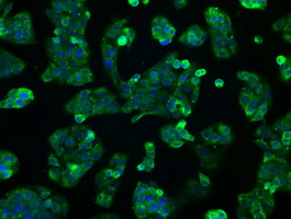 HSD17B10 / HADH2 Antibody - Immunofluorescent staining of HepG2 cells using anti-HSD17B10 mouse monoclonal antibody.