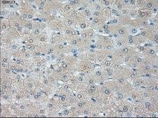 HSD17B10 / HADH2 Antibody - Immunohistochemical staining of paraffin-embedded liver tissue using anti-HSD17B10 mouse monoclonal antibody. (Dilution 1:50).