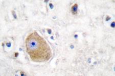 HSD17B10 / HADH2 Antibody - IHC of HADH2 (E135) pAb in paraffin-embedded human brain tissue.