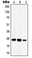 HSD17B10 / HADH2 Antibody - Western blot analysis of HADH2 expression in SKNSH (A); HEK293T (B); rat brain (C) whole cell lysates.