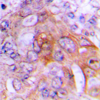 HSD17B10 / HADH2 Antibody - Immunohistochemical analysis of HADH2 staining in human lung formalin fixed paraffin embedded tissue section. The section was pre-treated using heat mediated antigen retrieval with sodium citrate buffer (pH 6.0). The section was then incubated with the antibody at room temperature and detected using an HRP conjugated compact polymer system. DAB was used as the chromogen. The section was then counterstained with hematoxylin and mounted with DPX.