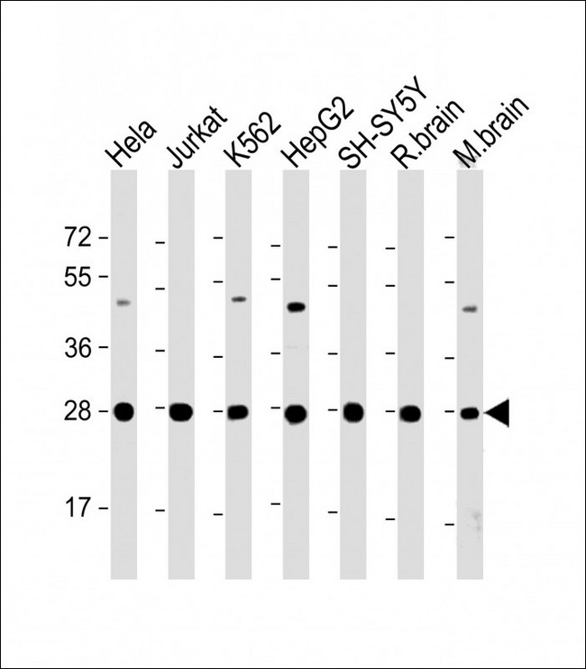 HSD17B10 / HADH2 Antibody - All lanes: Anti-HSD17B10 Antibody (Center) at 1:2000 dilution Lane 1: Hela whole cell lysate Lane 2: Jurkat whole cell lysate Lane 3: K562 whole cell lysate Lane 4: HepG2 whole cell lysate Lane 5: SH-SY5Y whole cell lysate Lane 6: rat brain lysate Lane 7: mouse brain lysate Lysates/proteins at 20 µg per lane. Secondary Goat Anti-Rabbit IgG, (H+L), Peroxidase conjugated at 1/10000 dilution. Predicted band size: 27 kDa Blocking/Dilution buffer: 5% NFDM/TBST.